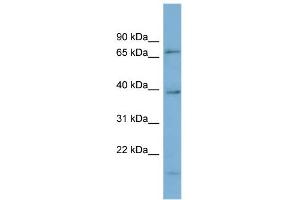 WB Suggested Anti-HP1BP3 Antibody Titration: 0. (HP1BP3 anticorps  (Middle Region))
