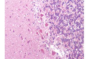 Human Cerebellum: Formalin-Fixed, Paraffin-Embedded (FFPE)