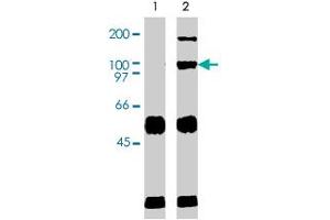Immunoprecipation results using western blot analysis. (VAV2 anticorps  (AA 287-578))
