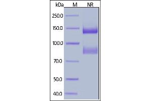 Integrin alpha V, Integrin beta 6 (ITGAV/ITGB6) (AA 31-992) (Active) protein (His tag,AVI tag,Biotin)