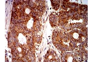 Immunohistochemistry (IHC) image for anti-Eukaryotic Translation Initiation Factor 5 (EIF5) (AA 1-300) antibody (ABIN5865324) (EIF5 anticorps  (AA 1-300))