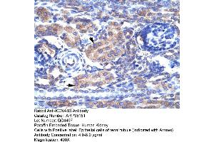 Human kidney (KCNAB3 anticorps  (N-Term))