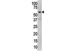 Western blot analysis of Tip60 antibody and CEM cell line lysate