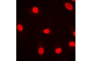 Immunofluorescent analysis of MZF1 staining in HeLa cells. (MZF1 anticorps  (N-Term))