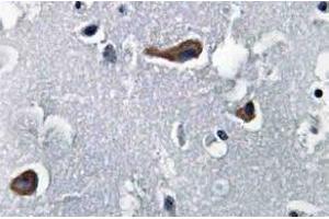 Immunohistochemistry (IHC) analyzes of MAP-2 antibody in paraffin-embedded human brain tissue. (MAP2 anticorps)