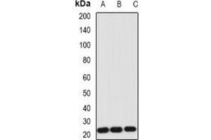 Western blot analysis of IL-1RA expression in Hela (A), NIH3T3 (B), HL60 (C) whole cell lysates. (IL1RN anticorps)