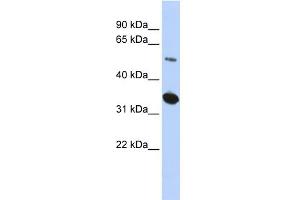 WB Suggested Anti-KIAA0157 Antibody Titration: 0. (FAM175B anticorps  (Middle Region))