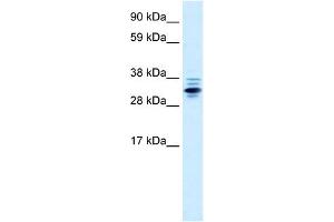 WB Suggested Anti-ZNF654 Antibody Titration:  0. (ZNF654 anticorps  (Middle Region))