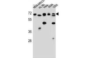 Western Blotting (WB) image for anti-acetylserotonin O-Methyltransferase-Like (ASMTL) antibody (ABIN2997228) (ASMTL anticorps)