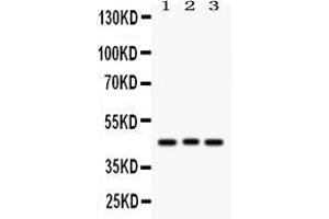 Western blot analysis of Ataxin 3 using anti-Ataxin 3 antibody . (Ataxin 3 anticorps  (C-Term))