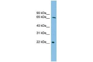 WB Suggested Anti-DYRK3 Antibody Titration:  0.
