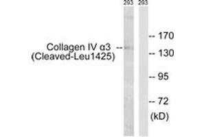 Western blot analysis of extracts from 293 cells, treated with etoposide 25uM 1h, using Collagen IV alpha3 (Cleaved-Leu1425) Antibody.