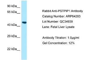 Western Blotting (WB) image for anti-Proline-serine-threonine Phosphatase Interacting Protein 1 (PSTPIP1) (N-Term) antibody (ABIN2789789) (PSTPIP1 anticorps  (N-Term))