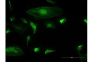 Immunofluorescence of monoclonal antibody to TRIM17 on HeLa cell.