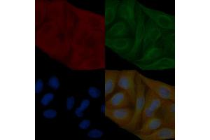 Annexin A2 Mouse Monoclonal Antibody staining Hela cells by IF/ICC.