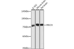 Western blot analysis of extracts of various cell lines, using PRKCB antibody (ABIN6128462, ABIN6146199, ABIN6146201 and ABIN6217699) at 1:1000 dilution. (PKC beta anticorps  (AA 1-270))