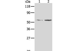 Western Blot analysis of Hela and 293T cell using AKR1B1 Polyclonal Antibody at dilution of 1:350 (AKR1B1 anticorps)