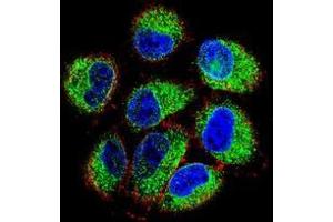 Confocal immunofluorescent analysis of TBC1D13 Antibody (Center) Cat.