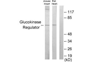 Western blot analysis of extracts from mouse heart cells and rat heart cells, using Glucokinase Regulator antibody. (GCKR anticorps  (Internal Region))