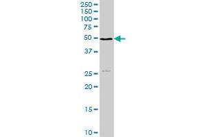 NSDHL MaxPab rabbit polyclonal antibody. (NSDHL anticorps  (AA 1-373))