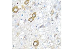 Immunohistochemistry of paraffin-embedded rat brain using MGP antibody at dilution of 1:100 (40x lens). (MGP anticorps)