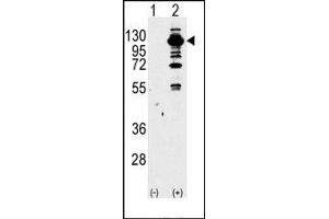 Image no. 1 for anti-Phosphoinositide-3-Kinase, Catalytic, gamma Polypeptide (PIK3CG) (Middle Region) antibody (ABIN360713)