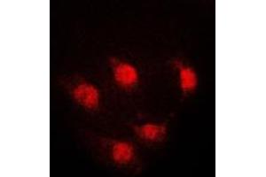 Immunofluorescent analysis of STAT5A staining in K562 cells. (STAT5A anticorps  (Center))