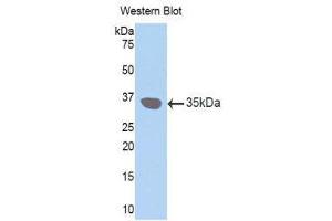 Western Blotting (WB) image for anti-Gap Junction Protein, beta 3, 31kDa (GJB3) (AA 210-270) antibody (ABIN1174655)