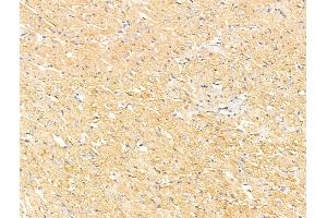 ABIN7094740 and ABIN7098791 at 1/100 staining Rat heart tissue by IHC-P. (DAB2IP anticorps  (C-Term))