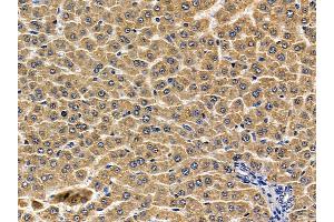 ABIN6256887 and ABIN6274764 at 1/100 staining rat liver tissue by IHC-P.