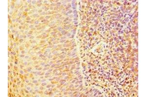 Immunohistochemistry of paraffin-embedded human tonsil tissue using ABIN7144328 at dilution of 1:100 (TAP1 anticorps  (AA 524-808))