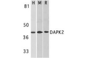 Western blot analysis of DAPK2 in A431 (H), mouse spleen (M), and rat kidney (R) lysates with AP30272PU-N DAPK2 antibody at 1 μg/ml. (DAPK2 anticorps)
