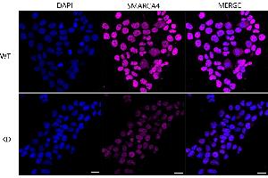 Immunocytochemical staining of Hela cells using SMARCA4 antibody (ABIN7800476), 1:1,000), Top panel: wild-type (WT), Bottom panal: SMARCA4 shRNA knockdown (KD).
