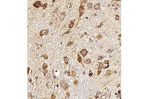 Immunohistochemistry analysis of paraffin embedded mouse spinal cord using Neurotensin (ABIN7074827) at dilution of 1: 400