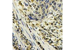 Immunohistochemistry (IHC) image for anti-S100 Calcium Binding Protein A8 (S100A8) antibody (ABIN7308306)
