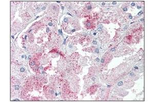 Immunohistochemistry: GPR146 antibody staining of Formalin-Fixed, Paraffin-Embedded Human Kidney. (GPR146 anticorps  (Internal Region))