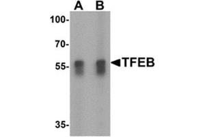 Western blot analysis of TFEB in A549 cell lysate with TFEB antibody at (A) 1 and (B) 2 ug/mL. (TFEB anticorps  (N-Term))