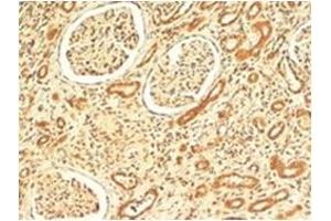 AP31712PU-N VPS41 antibody staining of paraffin embedded Human Kidney at 4 µg/ml. (VPS41 anticorps  (Internal Region))