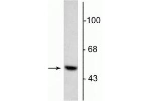Western blot of 5 µg of bovine adrenal medulla lysate showing specific immunolabeling of the ~55 kDa DOPA decarboxylase protein. (DDC anticorps  (N-Term))