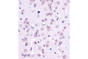 A staining YY1 in Rat brain tissue sections by Immunohistochemistry (IHC-P - paraformaldehyde-fixed, paraffin-embedded sections).