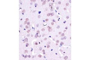 A staining YY1 in Rat brain tissue sections by Immunohistochemistry (IHC-P - paraformaldehyde-fixed, paraffin-embedded sections). (YY1 anticorps)