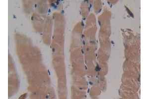 DAB staining on IHC-P; Samples: Mouse Skeletal muscle Tissue (MYH2 anticorps  (AA 1238-1472))