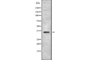 Western blot analysis of MAGA2 using 293 whole cell lysates (MAGEA2B anticorps  (C-Term))