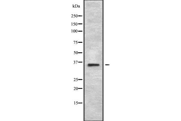 MAGEA2B anticorps  (C-Term)