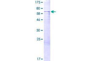 Image no. 1 for Migration and Invasion Inhibitory Protein (MIIP) (AA 1-388) protein (GST tag) (ABIN1318487)