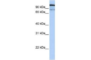 GAA antibody used at 1 ug/ml to detect target protein.