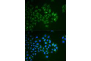 Immunofluorescence analysis of HeLa cell using SYT1 antibody.