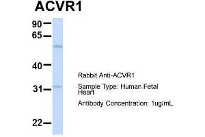 Host:  Rabbit  Target Name:  ACVR1  Sample Type:  Human Fetal Heart  Antibody Dilution:  1. (ACVR1 anticorps  (N-Term))