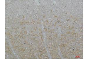 Immunohistochemistry (IHC) analysis of paraffin-embedded Rat Brain Tissue using Cav3.