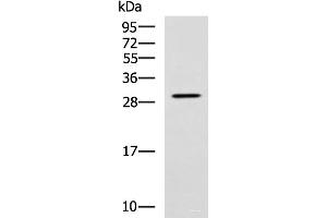 Western blot analysis of SP20 cell lysate using LRAT Polyclonal Antibody at dilution of 1:800 (LRAT anticorps)